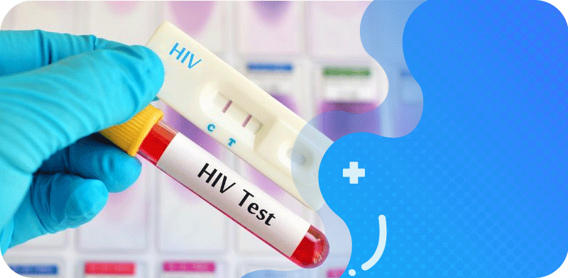 Xét-nghiệm-HIV